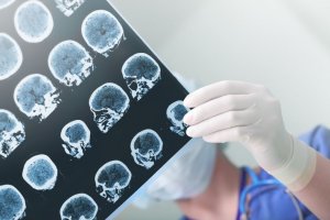 Introdução à Avaliação Neuropsicológica de Pré Escolares, Crianças e Adolescentes