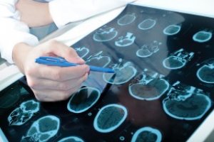 Introdução à Neuropsicologia