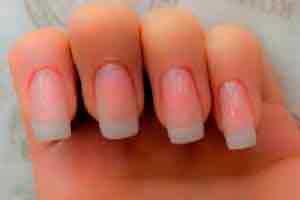 Estética