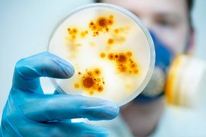 Controle de Microrganismos - Agentes Físicos e Químicos